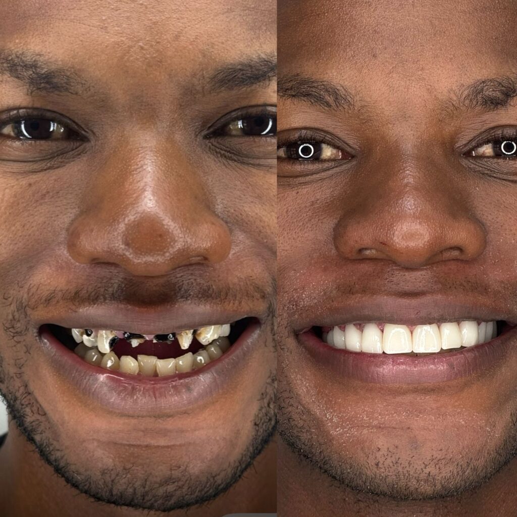 broken tooth,parktown north